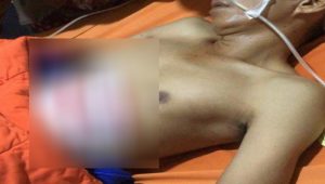 Kadus lampukuning Kadus lampukuning